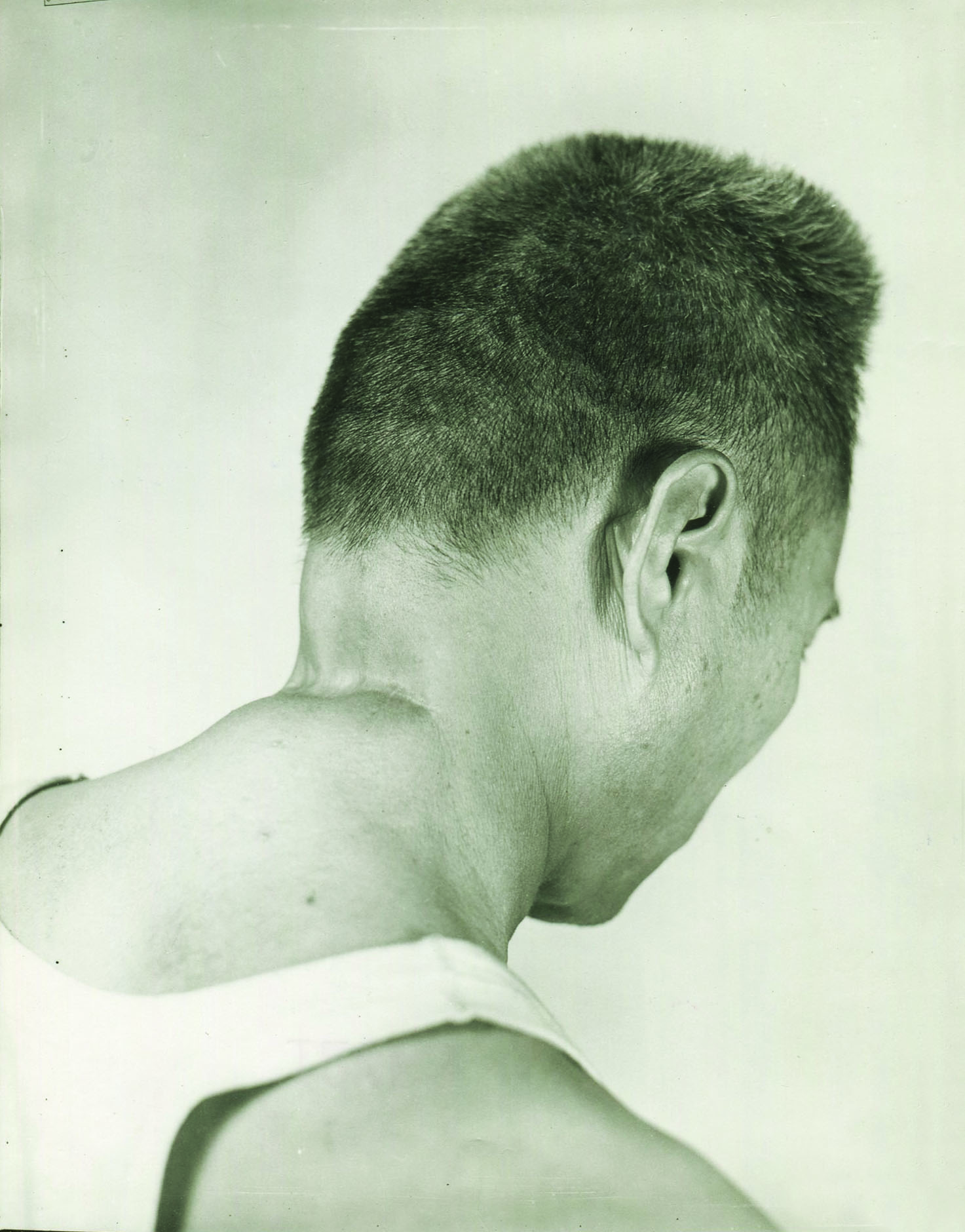 Evidence of the methodical nature of the Japanese troops' brutality, including testimony by survivors of decapitation attempts, led Yamashita to be found guilty of war crimes. (National Archives)